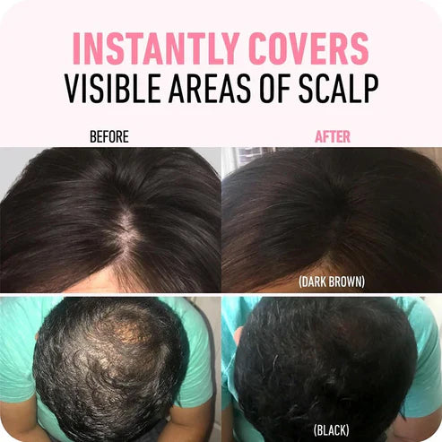 Revive Your Hairline Powder™