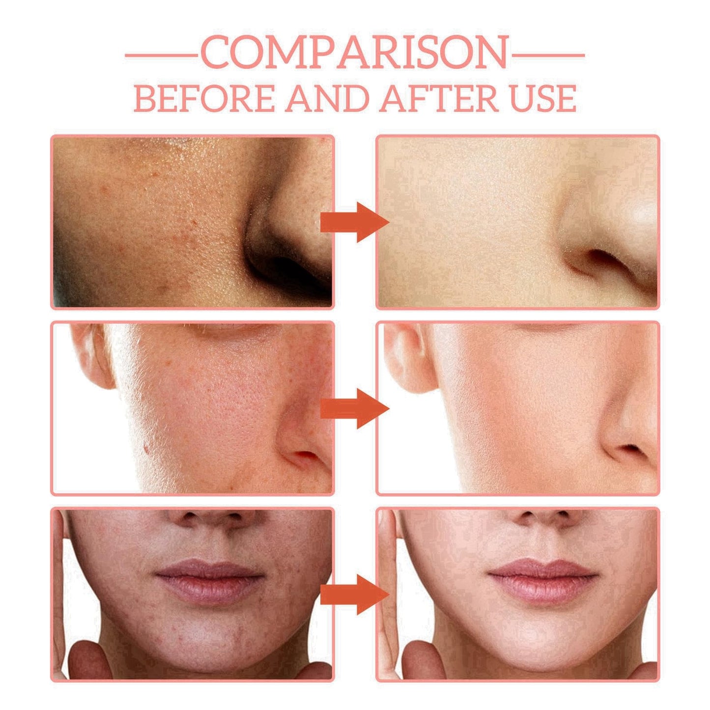 Aobenz Dark Spot Remover