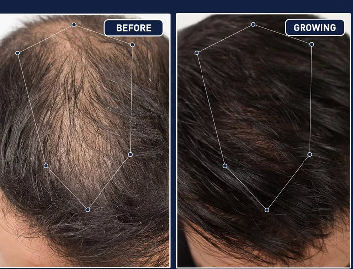 FEG Plus Hair Strong Growth Spray