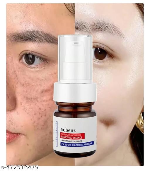 Aobenz Dark Spot Remover