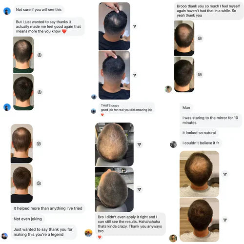 Revive Your Hairline Powder™