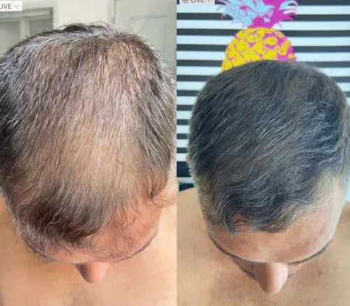 Revive Your Hairline Powder™