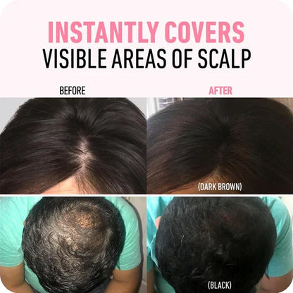 Revive Your Hairline Powder™