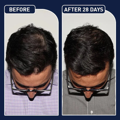 FEG Plus Hair Strong Growth Spray