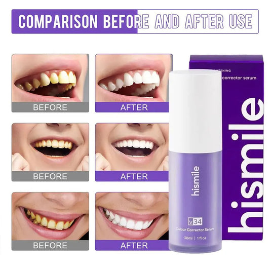 SmileKit No More Yellow Stains,(  imported From USA )