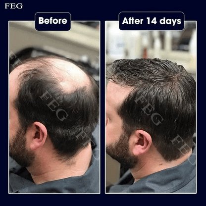 FEG Plus Hair Strong Growth Spray