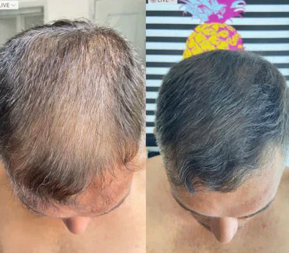 Revive Your Hairline Powder™